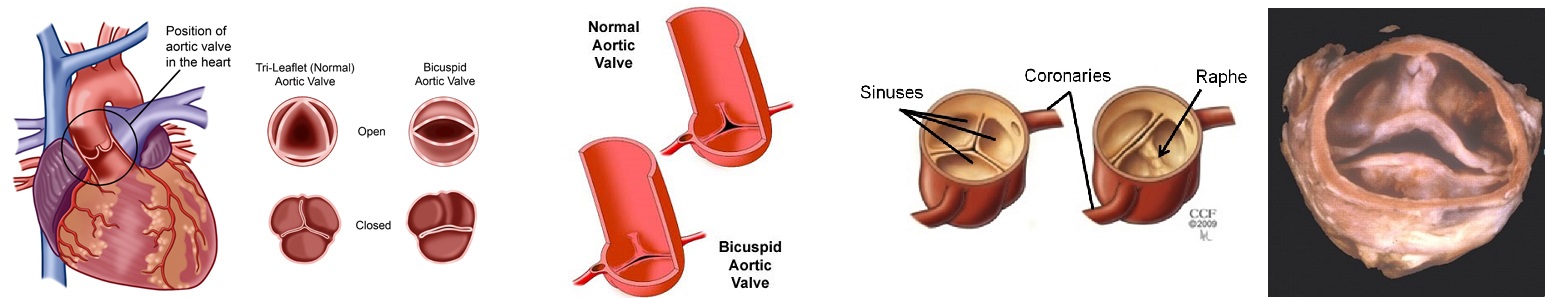anatomia diptixis aortikis